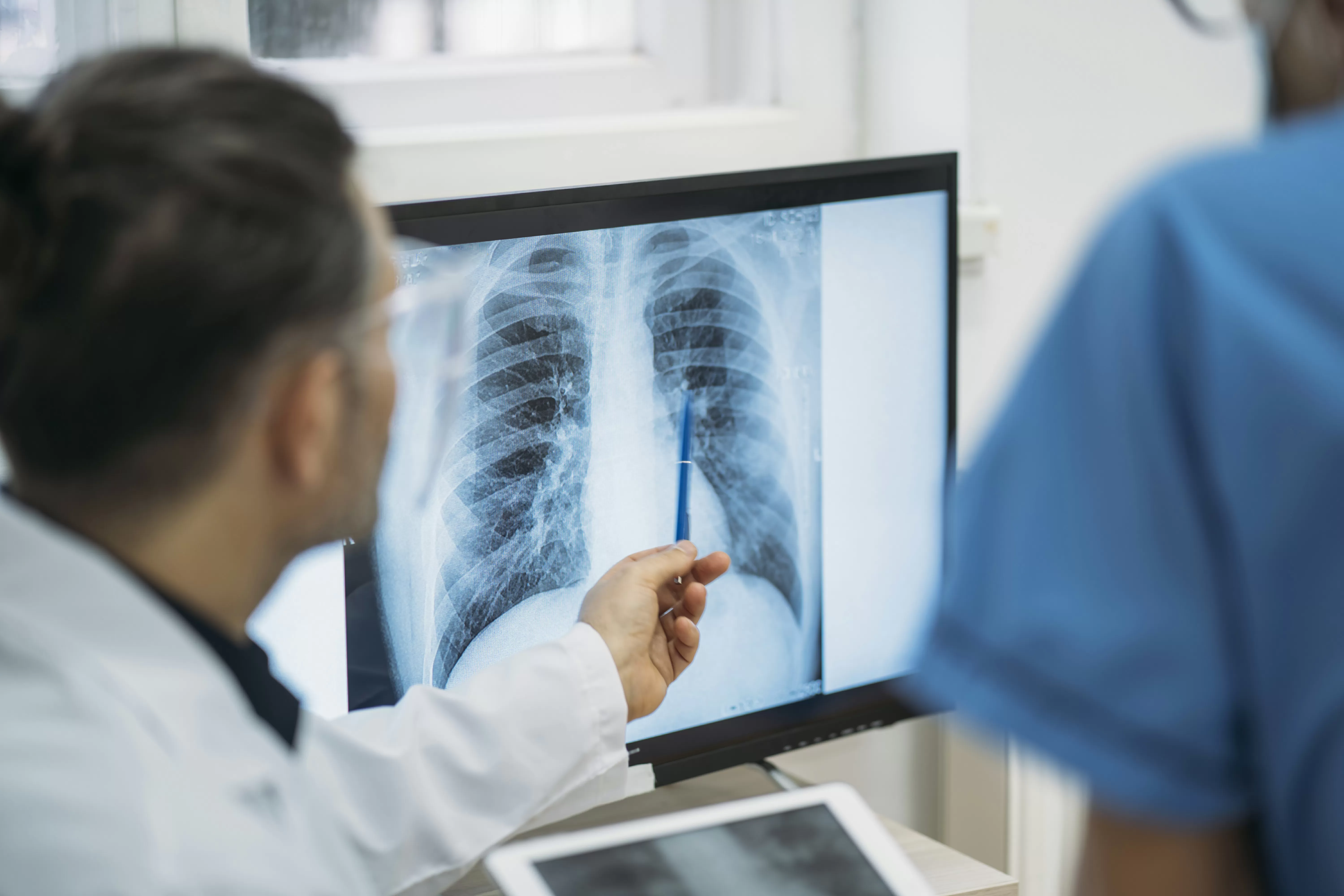 Brasil não alcança meta da OMS para controle da tuberculose