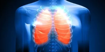 Novas terapias e tecnologias trazem avanços para tratar câncer de pulmão