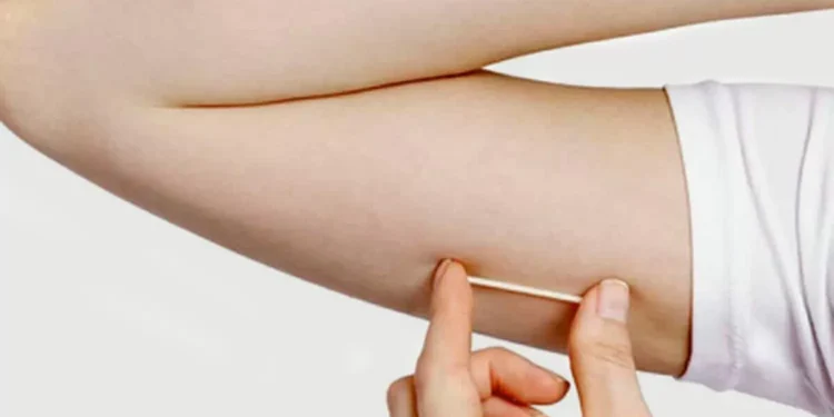 ‘Chip da beleza’: Anvisa inclui exigência de receita especial e termo sobre riscos