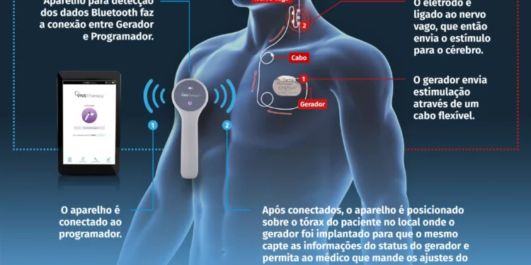 Pacientes com epilepsia vão à Justiça por terapia aprovada, mas indisponível no SUS
