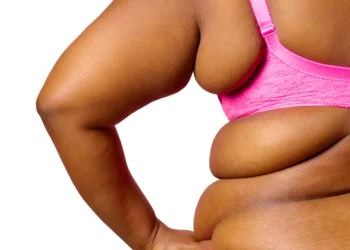 A obesidade e a cirurgia bariátrica estão com os dias contados?