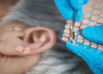Auriculoterapia funciona? O que dizem as evidências