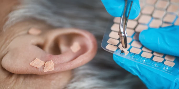 Auriculoterapia funciona? O que dizem as evidências