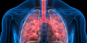 Anticoagulante popular demonstra potencial para tratar inflamação pulmonar