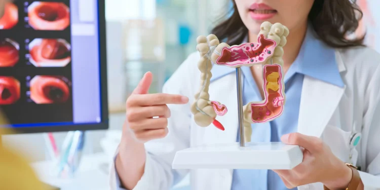 Casos de câncer de intestino no país devem saltar 21% nos próximos 15 anos