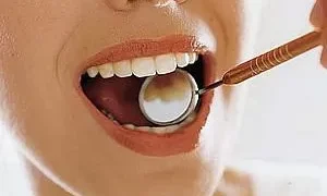 O benefício do canabidiol para os dentes, segundo estudo