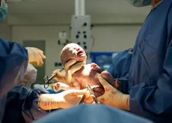 Vidas de milhões de bebês podem mudar com simples teste do cordão umbilical; entenda