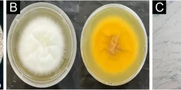 Primeiro caso e surto: os superfungos que preocupam hospitais brasileiros