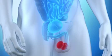 Câncer de testículo: por que não dá para bobear e esquecer a doença