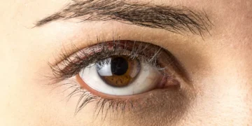 Levantamento contabiliza danos à visão em mutirões oftalmológicos no Brasil