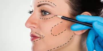 A era do indetectável: procedimentos estéticos agora buscam a naturalidade