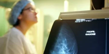 Luz contra o câncer de mama: nova tecnologia pretende descobrir focos da doença