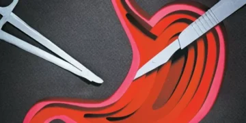 A terapia que devolveu a esperança para curar o câncer de estômago