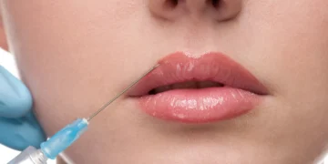 Anvisa proíbe lote falsificado de botox após alerta de empresa