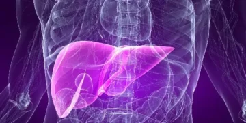 Doença metabólica do fígado: por que se proteger desse problema silencioso