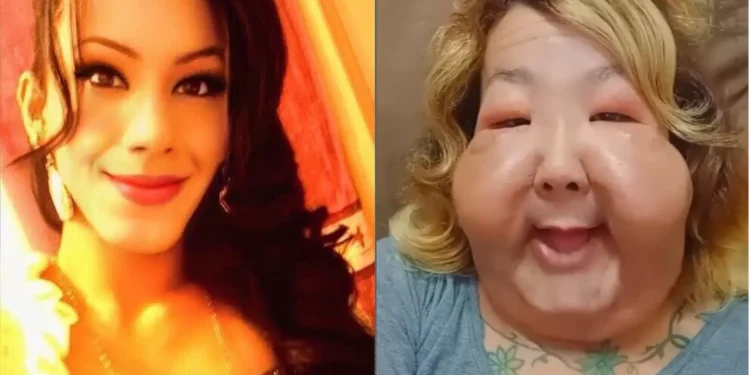 Juju do Pix passa por cirurgia reparadora para retirar óleo mineral