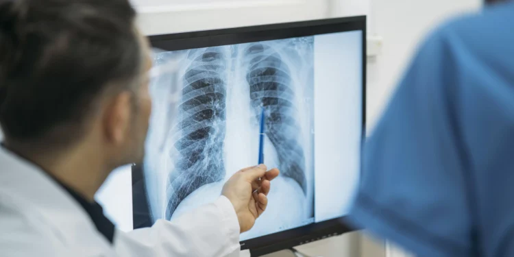 Brasil não alcança meta da OMS para controle da tuberculose