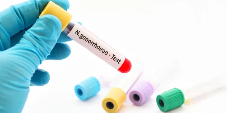 Novo antibiótico contra gonorreia é aprovado após décadas sem inovações