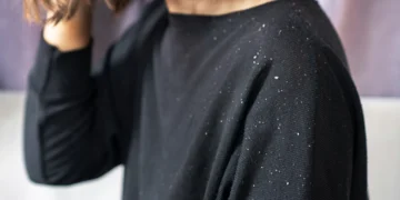 Caspa pode ser diferente em homens e mulheres: o que muda no tratamento?