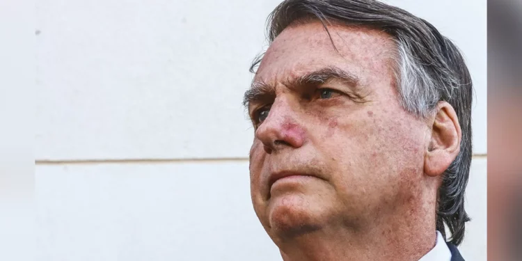 Apneia do sono e CPAP: entenda distúrbio que afeta Bolsonaro e o tratamento