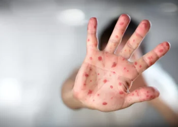 Saúde de SP alerta para risco de reintrodução do sarampo durante temporada de cruzeiros