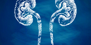 Pedras nos rins: problema pode ser silencioso e se agravar nesta época