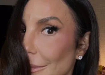 Ivete Sangalo mostra hematomas após acidente: “Só bora”