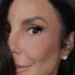 Ivete Sangalo mostra hematomas após acidente: “Só bora”