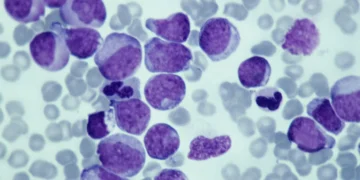 Como as terapias-alvo estão mudando o tratamento do câncer