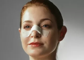 Plástica no nariz produz transformações até no cérebro