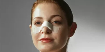 Plástica no nariz produz transformações até no cérebro